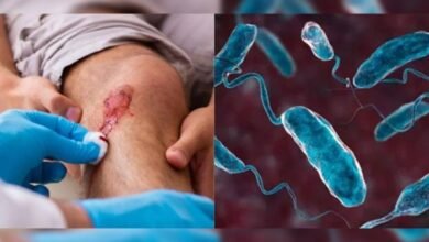 Estos son lo síntomas y riesgos de la bacteria carnívora