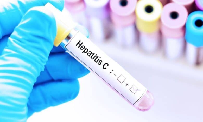 Hepatitis C.