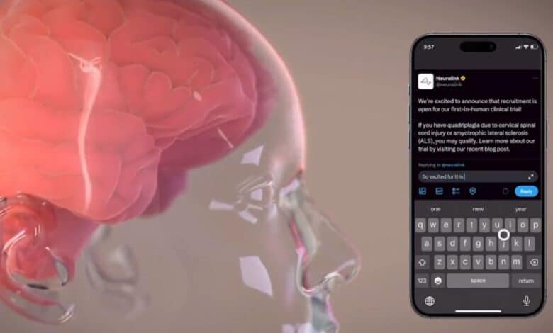 Neuralink.