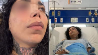 Paola Suárez ya presenta mejoras en su salud ocular tras ser golpeada por su prometido