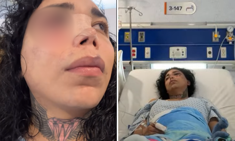 Paola Suárez ya presenta mejoras en su salud ocular tras ser golpeada por su prometido
