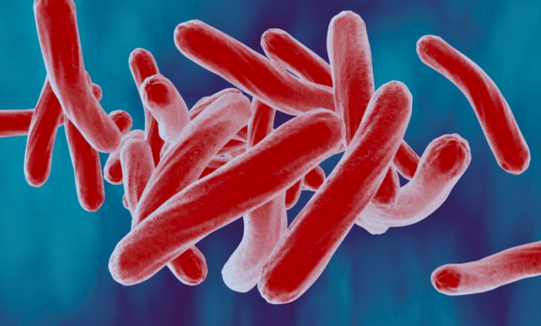 Detectan casos de tuberculosis en migrantes de Chicago