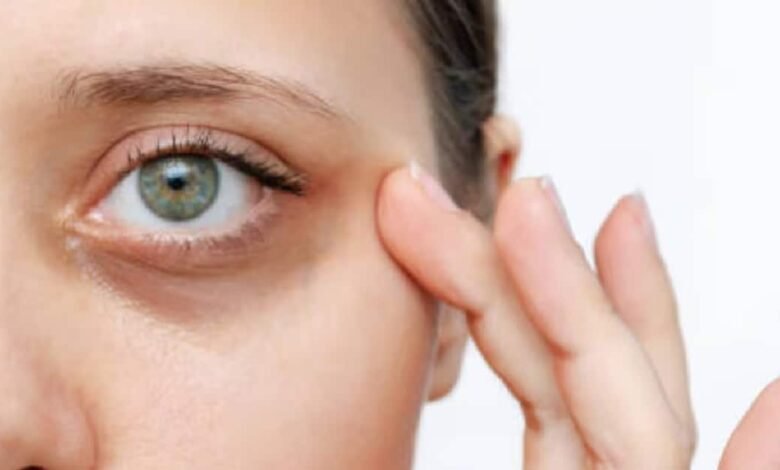 Dile adiós a las ojeras: remedios para dormir sin complicaciones (Foto de internet)