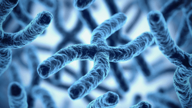 Síndrome 22q11 características y diagnóstico clave