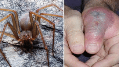 Piquete de araña violinista: ¿Cómo identificarla y qué hacer si te pica?