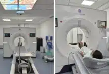 Tomógrafo de alta generación revolucionará la atención médica en el IMSS Tabasco