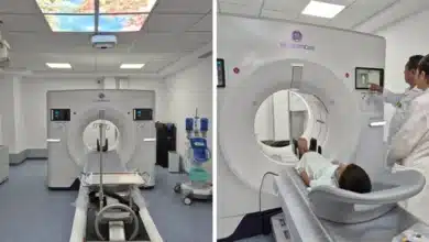 Tomógrafo de alta generación revolucionará la atención médica en el IMSS Tabasco