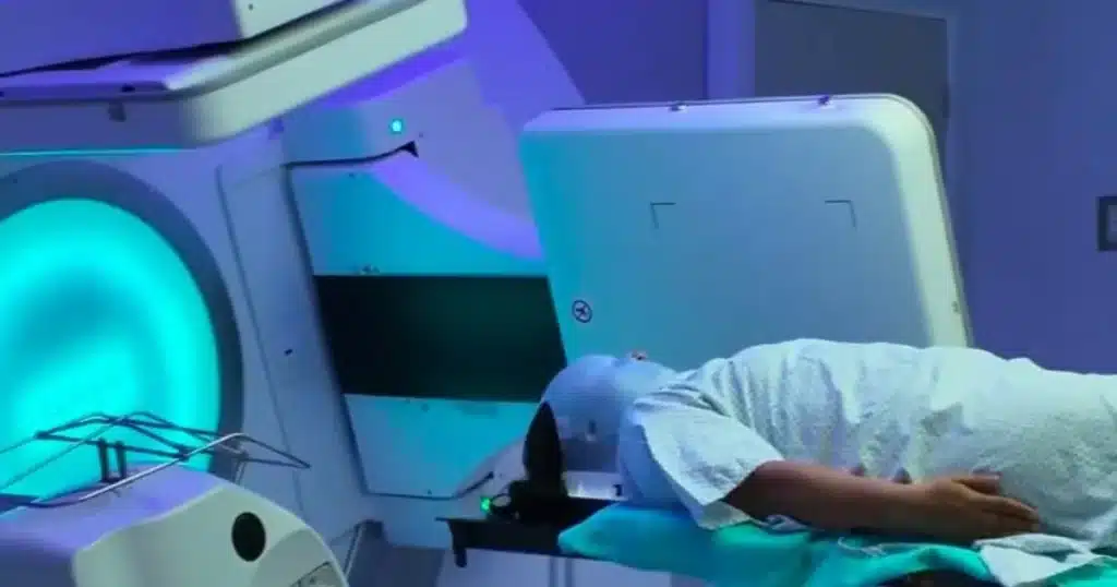 radioterapia gratuita en tabasco (1)
