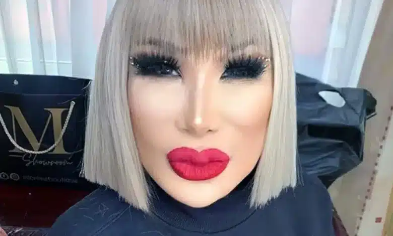 lyn may revela cómo vivió el cambio en su rostro