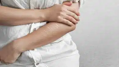 detectan casos de cutting en jóvenes