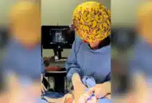salvan riñones a niño de 3 años con tumor bilateral