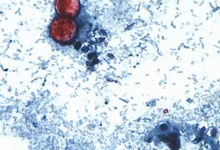 estados unidos confirma dos muertes por brote de ciclosporiasis asociado al parásito cyclospora