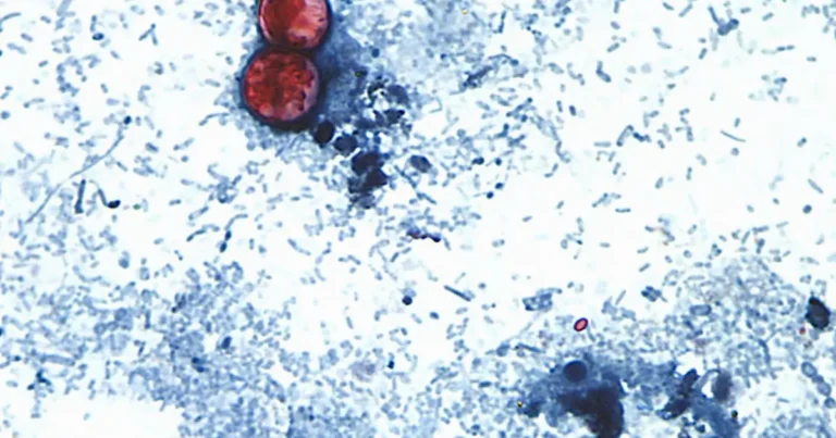 estados unidos confirma dos muertes por brote de ciclosporiasis asociado al parásito cyclospora